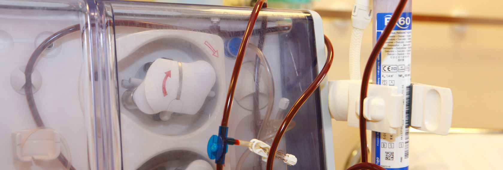 Die Dialyse-Einheit verfügt über moderne Geräte zur Blutwäsche, um den Bedürfnissen der Patienten gerecht zu werden